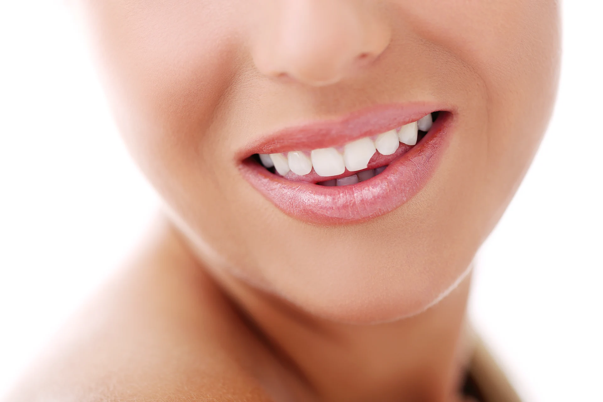 Chipped Tooth