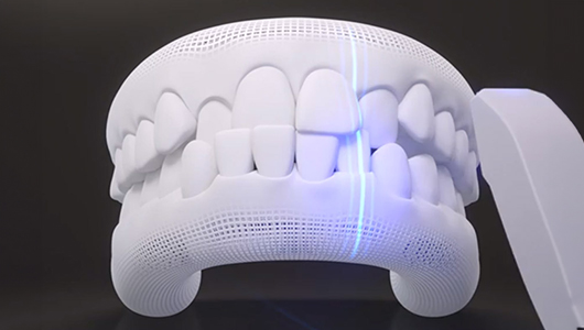 itero device 2