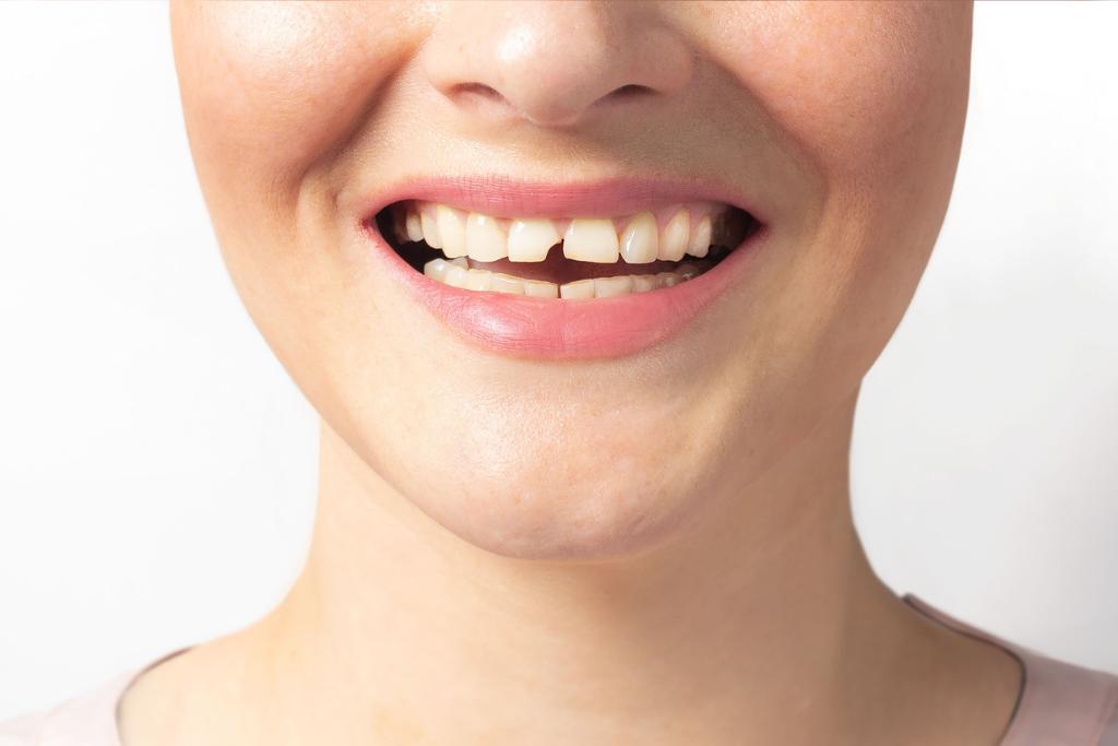 Dental Emergency Burnaby BC Dentist open weekends