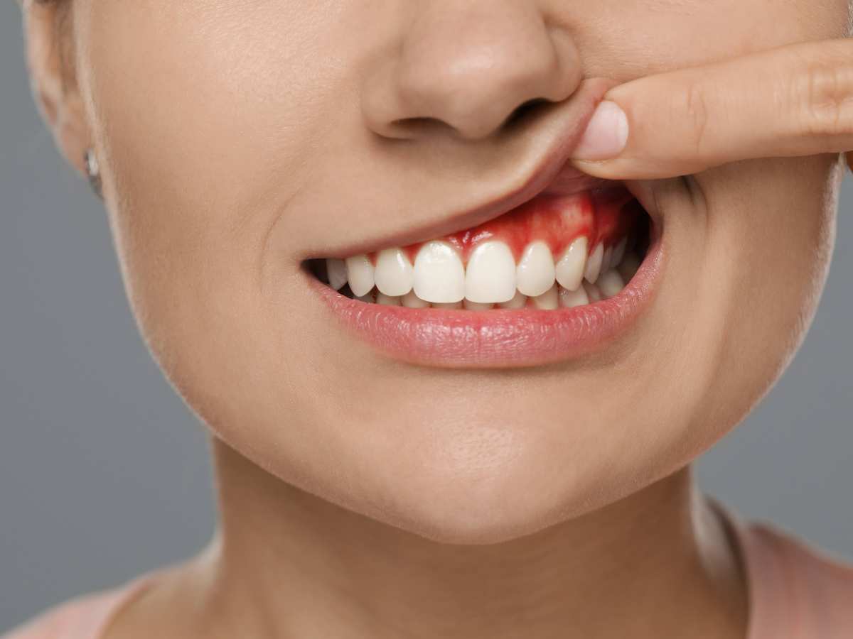 Gum Disease and Tooth Loss