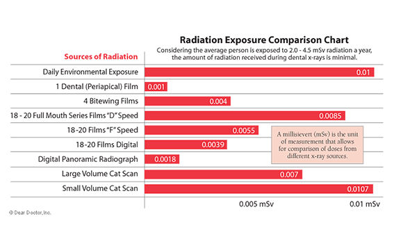 radiation-exposure-chart Composite Fillings